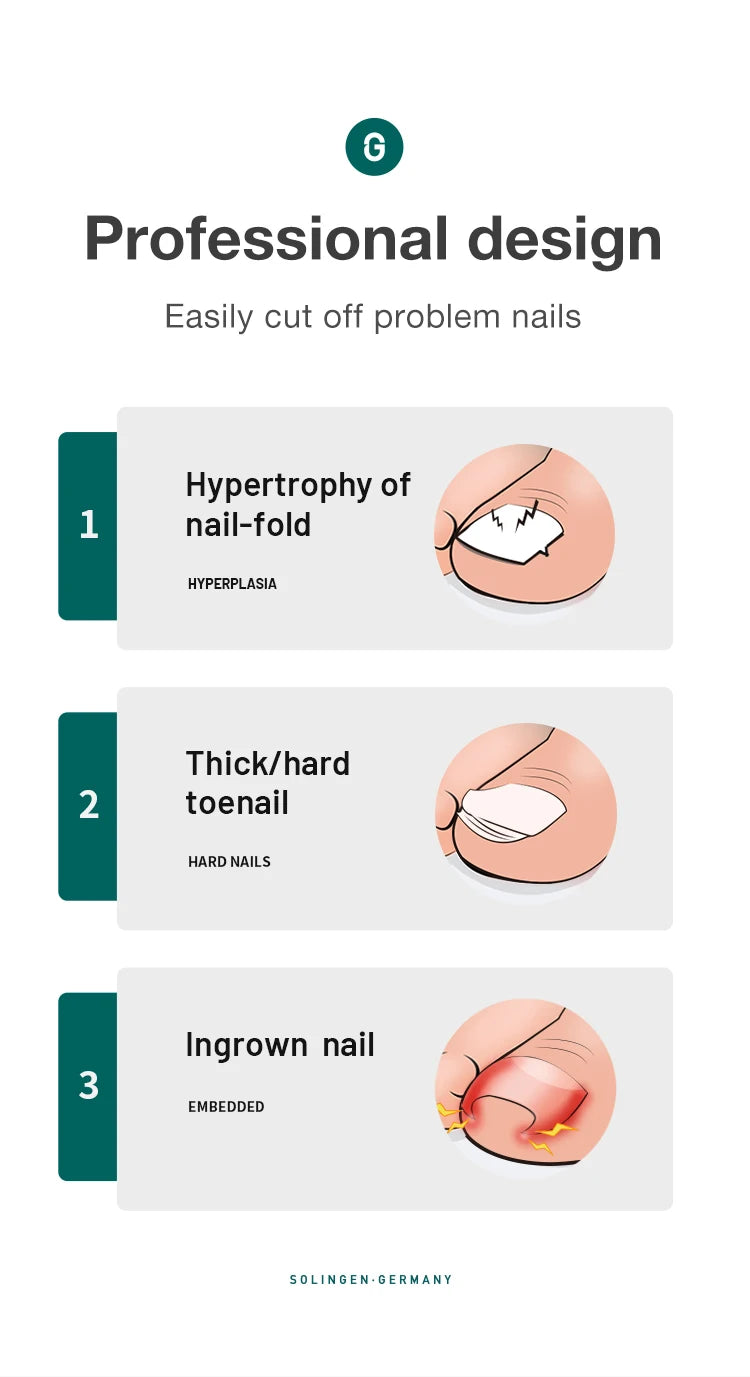 Cortaúñas Profesional MR.GREEN — Acero Inoxidable para Uñas Encarnadas